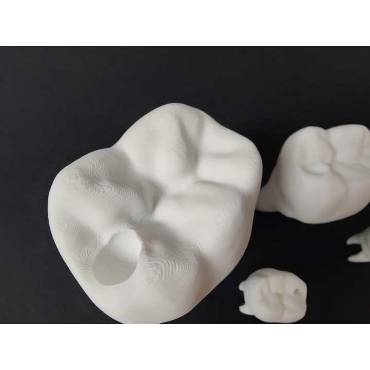 Ząb z ubytkiem do uzupełnienia - model zęba (duży, 10 cm)