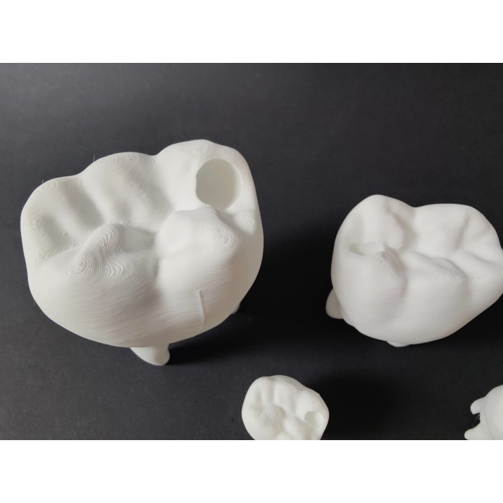 Ząb z ubytkiem do uzupełnienia - model zęba (duży, 10 cm)
